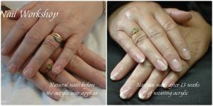 Natural Nails after the correct and safe removal 